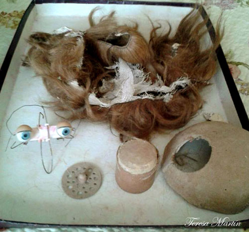 RESTAURACION-CLINICA- MUÑECAS