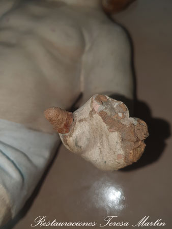 restauracion de manos son dedos escayola