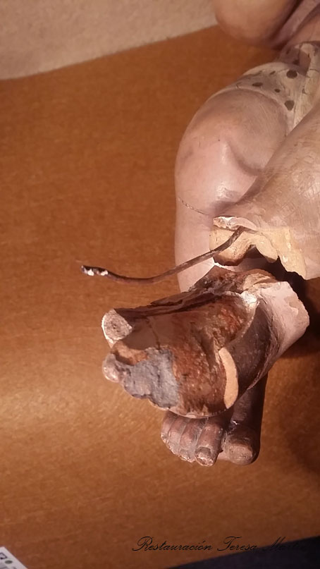 RESTAURACION NI&NTILDE;O JESUS 